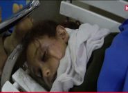 ۱۰۰ شهید و زخمی در تجاوز جدید سعودی‌ها به صنعا